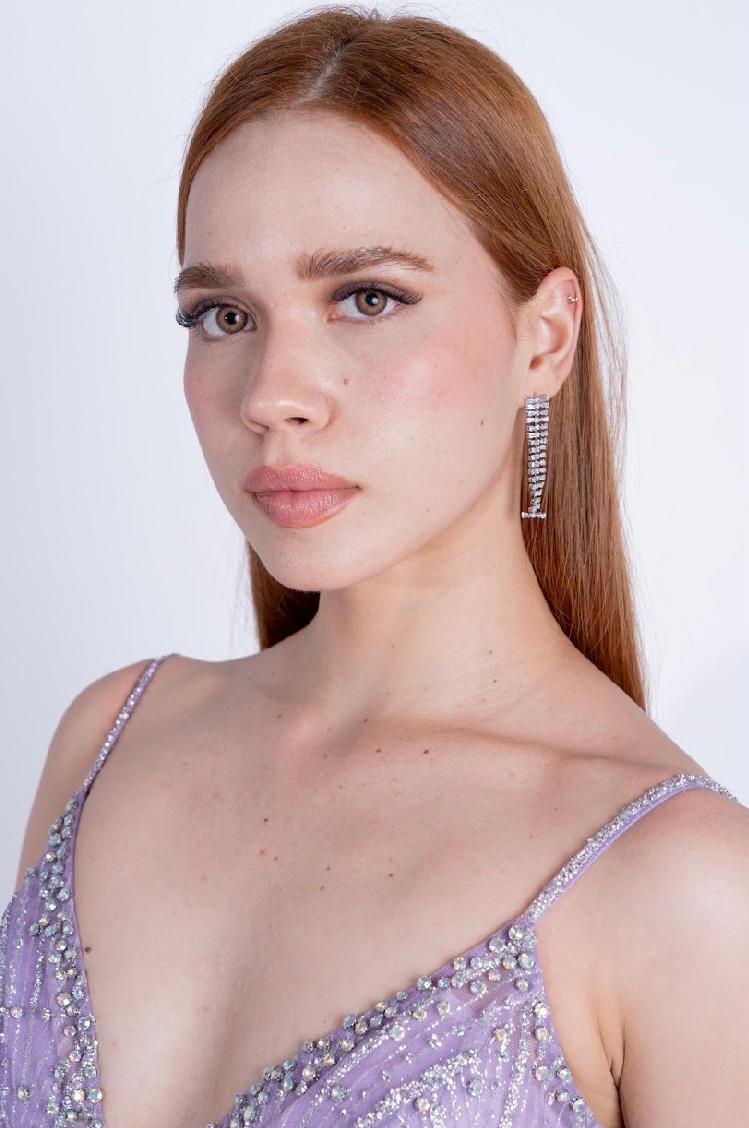 Aretes de red